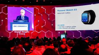 Terve Research conectează cercetătorii europeni cu utilizatorii de ceasuri Huawei; primele studii încep în septembrie