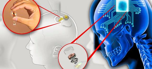 Se caută oameni pentru implant de cip în creier; Neuralink acceptă înscrieri de la voluntari