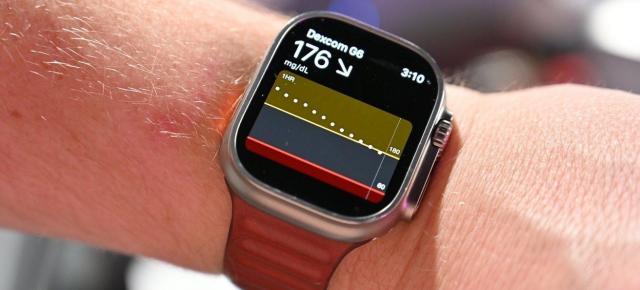 Monitorizarea glicemiei se va face prin cureaua de Apple Watch Series 12 (Zvon)