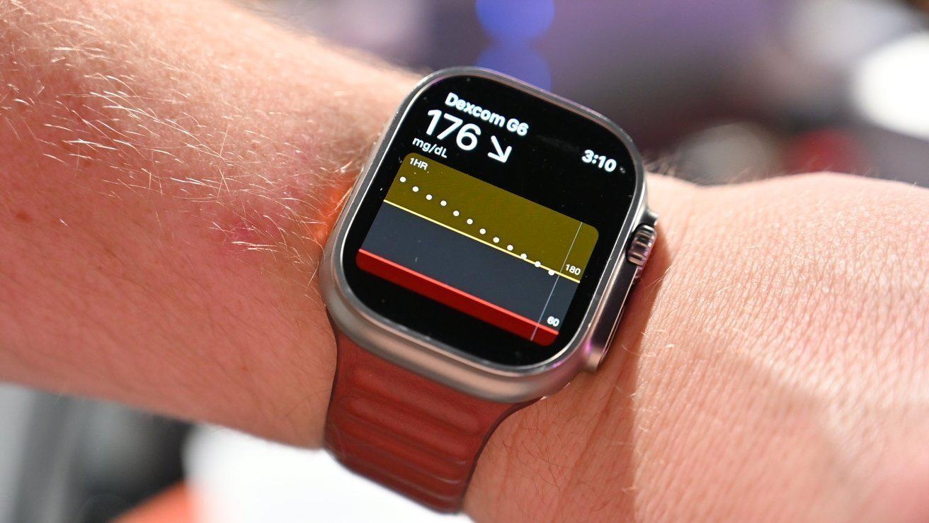 Monitorizarea glicemiei se va face prin cureaua de Apple Watch Series 12 (Zvon)