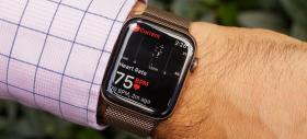 Apple testează un AI care analizează comportamentul utilizatorilor de Apple Watch pentru a detecta probleme de sănătate